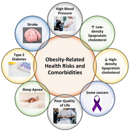 Obesity-related health risks and comorbidities