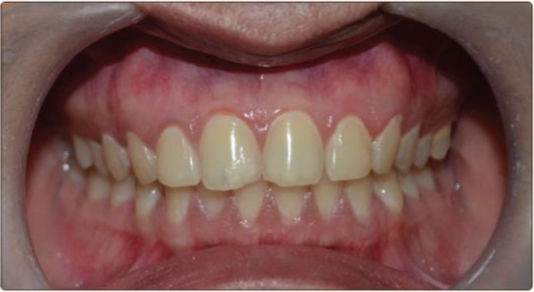 Healthy periodontic condition